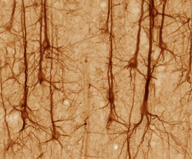 Neurony v mozkové kůře: FOTO: UC Regents Davis campus / Creative Commons / CC BY 3.0